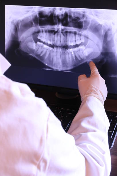 Best Chipped Tooth Repair Near Me  in Algona, IA